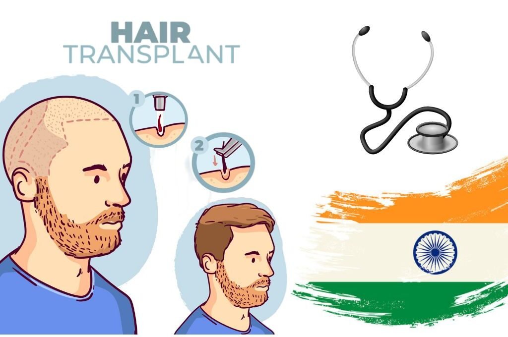 Hair Transplant